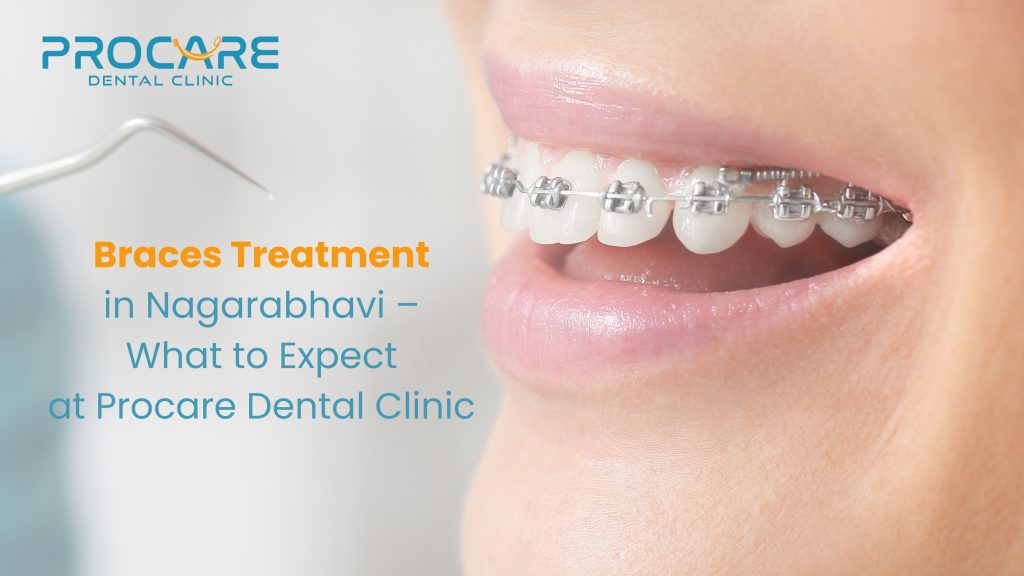 Braces Treatment in Banashankari – What to Expect at Procare Dental Clinic