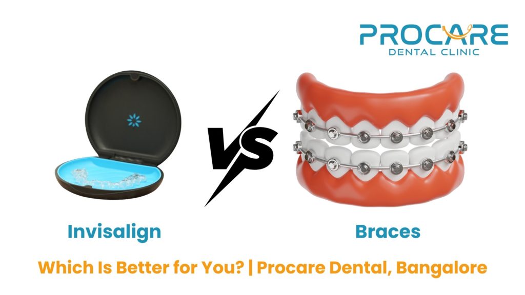 Invisalign vs Braces: Which Is Better for You? | ProCare Dental, Bangalore